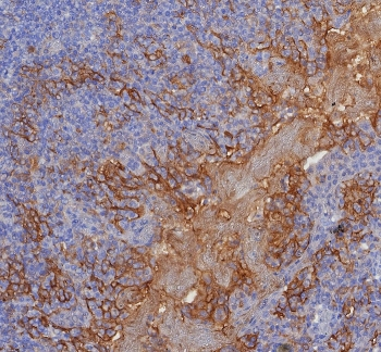 PD-L1 Antibody / B7-H1 / CD274