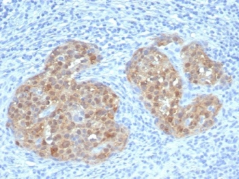 CDKN2A Antibody / p16INK4a