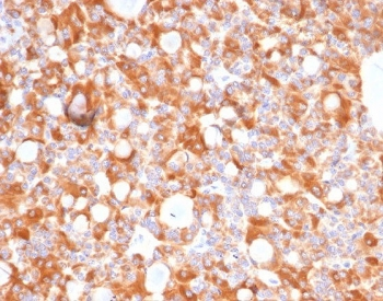 CA9 Antibody / Carbonic Anhydrase IX