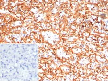 ADCY8 Antibody / Adenylyl cyclase 8