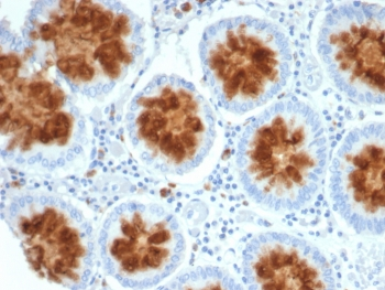 TrkB Antibody / NTRK2