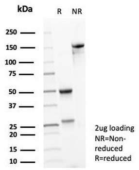 TrkB Antibody / NTRK2