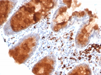 TrkB Antibody / NTRK2