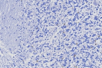 TRPS1 Antibody / Tricho-rhino-phalangeal syndrome type I