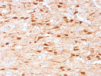 NECAB1 Antibody / N-terminal EF-hand calcium binding protein 1
