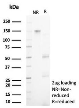 NECAB1 Antibody / N-terminal EF-hand calcium binding protein 1