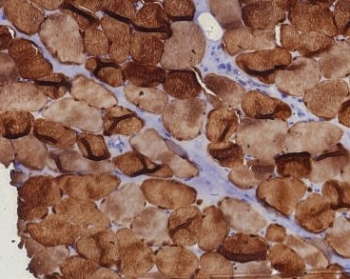 CA3 Antibody / Carbonic Anhydrase III