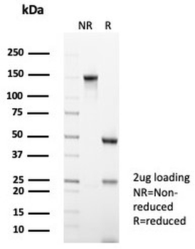 CA3 Antibody / Carbonic Anhydrase III