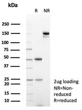 CA3 Antibody / Carbonic Anhydrase III