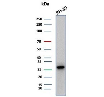 CA3 Antibody / Carbonic Anhydrase III