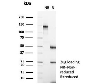 CA3 Antibody / Carbonic Anhydrase III