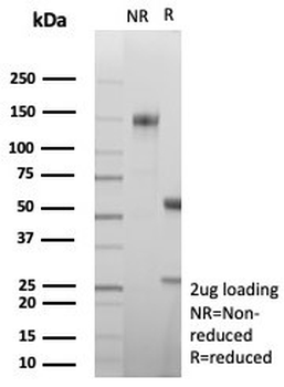 CA8 Antibody / Carbonic Anhydrase VIII