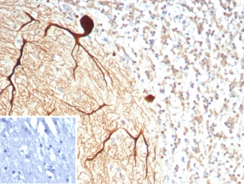 Carbonic Anhydrase VIII Antibody / CA8