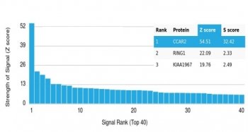 DBC1 Antibody / Deleted in breast cancer 1 / CCAR2
