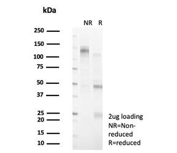 DBC1 Antibody / Deleted in breast cancer 1 / CCAR2
