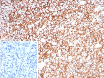 Clusterin Antibody / Apolipoprotein J / APO-J