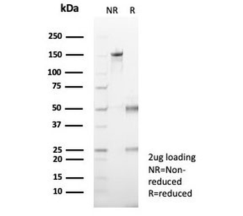 EZH2 Antibody / Enhancer of zeste homolog 2