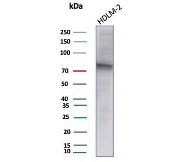 EZH2 Antibody / Enhancer of zeste homolog 2