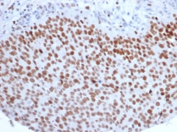 EZH2 Antibody