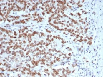 EZH2 Antibody