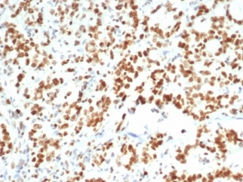 EZH2 Antibody