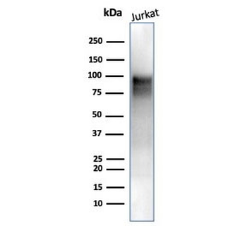 EZH2 Antibody