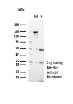 GCDFP-15 Antibody / PIP / Prolactin-Induced Protein