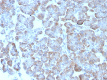 ADCY8 Antibody / Adenylyl cyclase 8