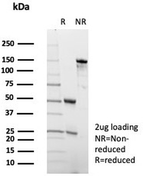 ADCY8 Antibody / Adenylyl cyclase 8