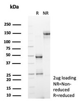 ADCY8 Antibody / Adenylyl cyclase 8