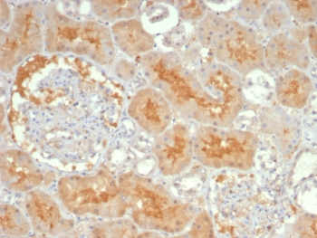 ADCY8 Antibody / Adenylyl cyclase 8