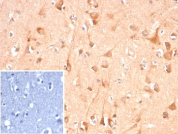 ADCY8 Antibody / Adenylyl cyclase 8