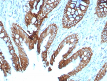 Cadherin 17 Antibody / CDH17
