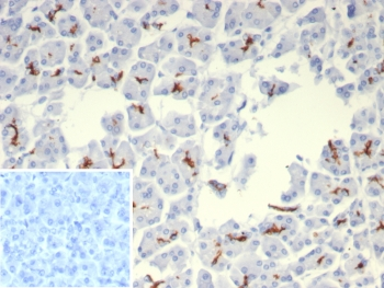 CFTR Antibody / Cystic Fibrosis Transmembrane Regulator