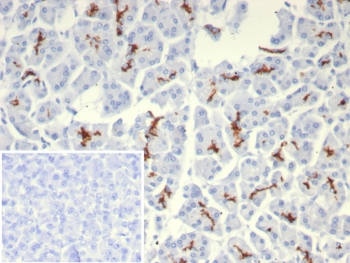 CFTR Antibody / Cystic Fibrosis Transmembrane Regulator
