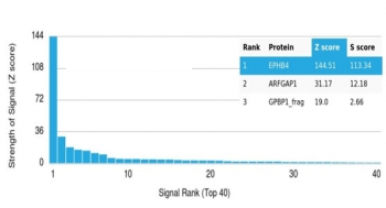 EPHB4 Antibody / EPH Receptor B4