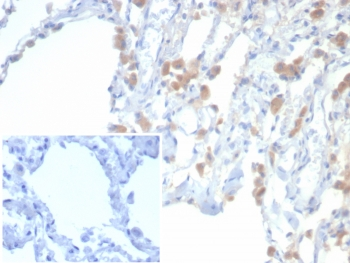EPHB4 Antibody / EPH Receptor B4