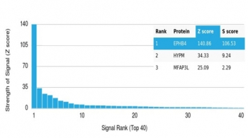 EPHB4 Antibody / EPH Receptor B4
