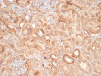 EPHB4 Antibody / EPH Receptor B4