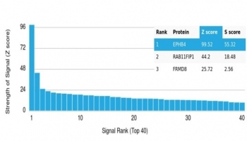 EPHB4 Antibody / EPH Receptor B4