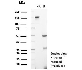 PON1 Antibody