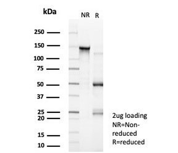 GTF2I Antibody / TFII-I