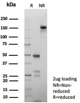 PMS2 Antibody / Post Meiotic Segregation Increased 2