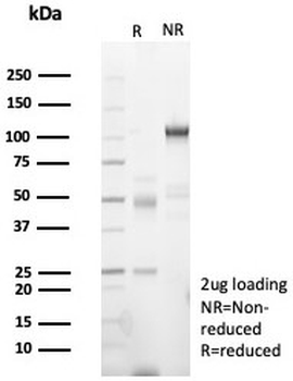 PMS2 Antibody / Post Meiotic Segregation Increased 2