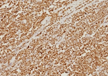 PMS2 Antibody / Post Meiotic Segregation Increased 2