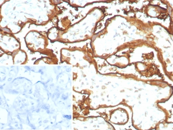 Epidermal Growth Factor Receptor Antibody / EGFR