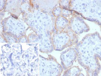 EGF Receptor / EGFR Antibody