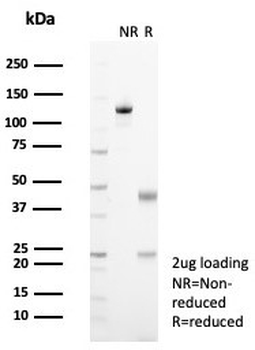 EGF Receptor / EGFR Antibody