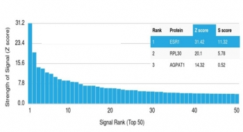 ER alpha Antibody / Estrogen Receptor alpha