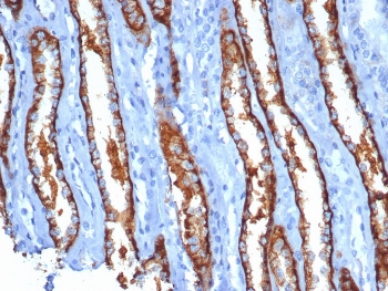 IL20RA Antibody / IL-20 receptor subunit alpha